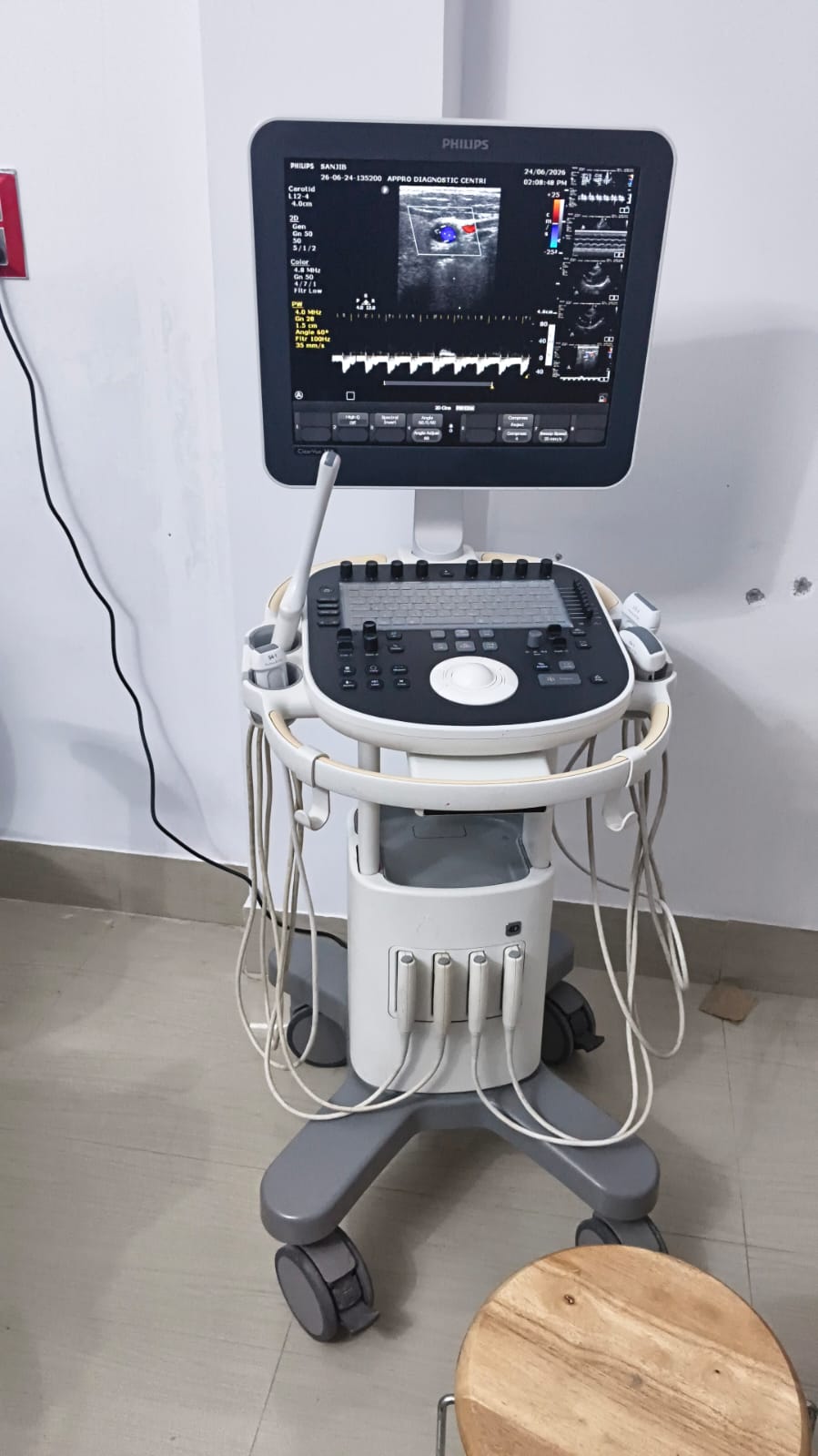 Ultrasound